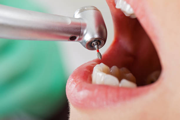 Best Dentist for Tooth Abscess  in Riverside, MD